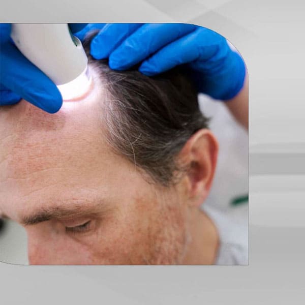 hair transplant clinic