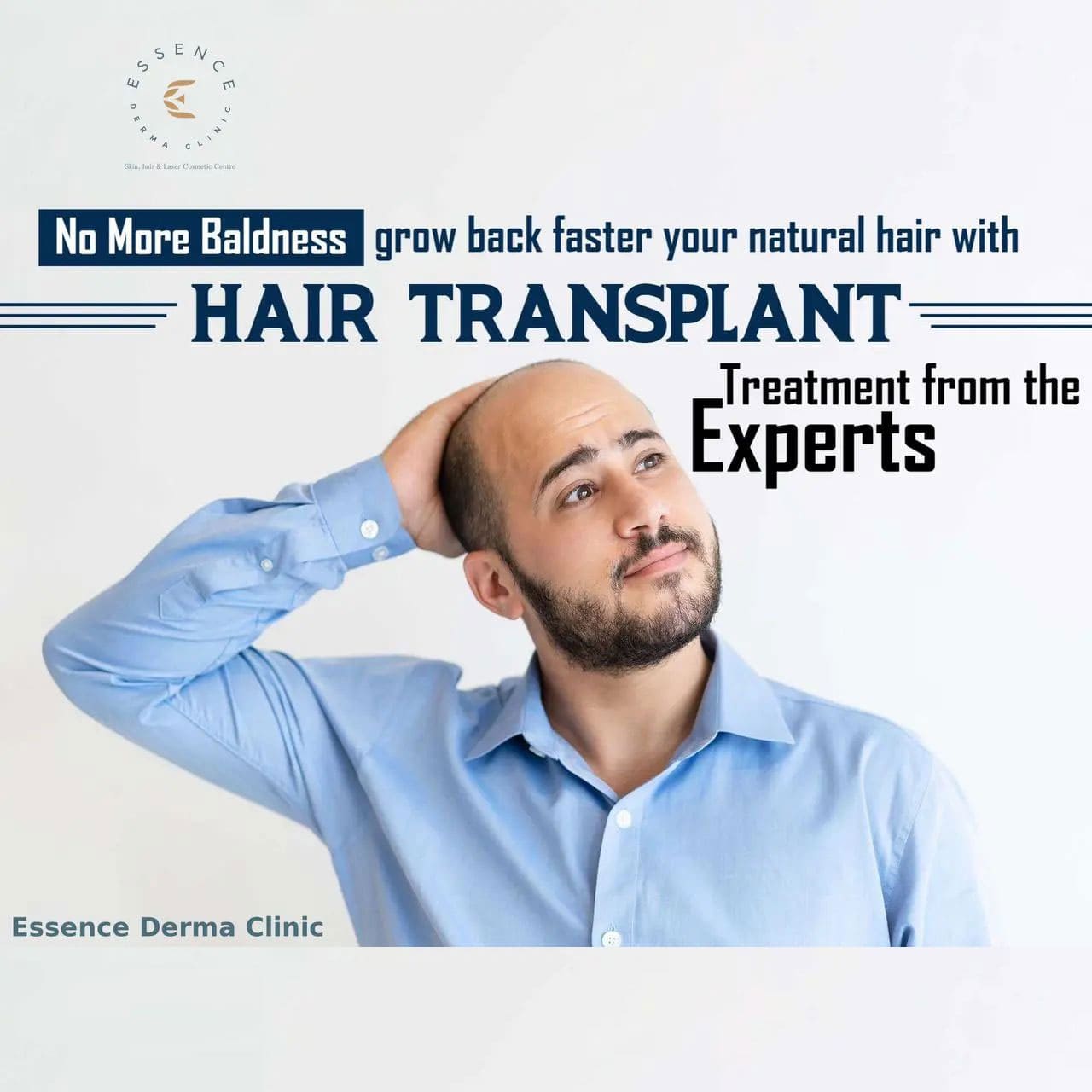 experts hair transplants